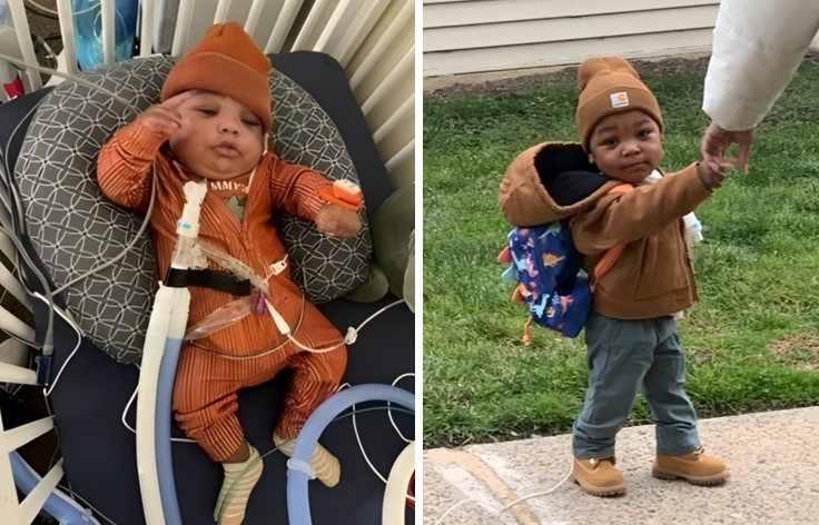 Drew Before and After